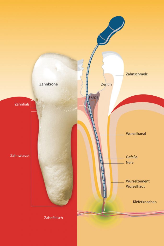 Endodontologie Zahnarztpraxis Dr Rudi